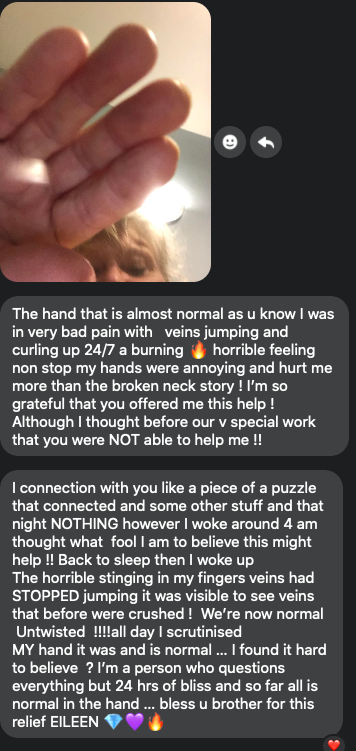 "Testimonial from Eileen about Michael’s guidance, Mirror Therapy combined with Meditative-Energizing Soundbath ∞ Vibrational Alignment Journey describing the release of severe pain and burning sensations in her hand, with veins returning to normal function and lasting relief."